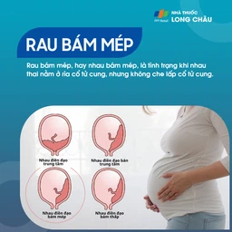 Rau bám mép 1