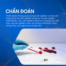 Hội chứng Down 5