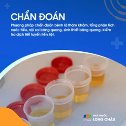 Viêm bàng quang mạn tính 5