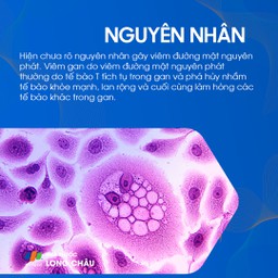 Viêm đường mật nguyên phát 3