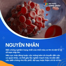 Nhồi máu cơ tim 3