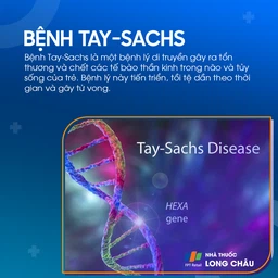 Tay-sachs 1