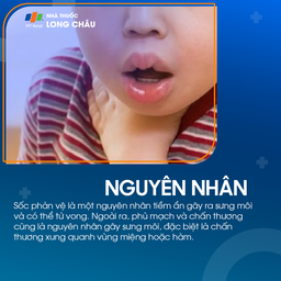 Sưng môi 3