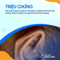 Tật tai nhỏ 2