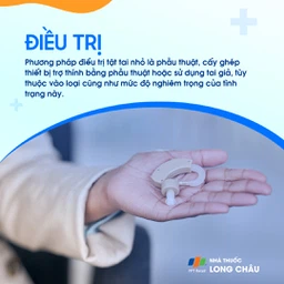 Tật tai nhỏ 6
