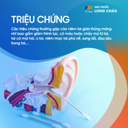Viêm tai giữa thủng màng nhĩ 2