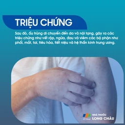 Giun đầu gai 2