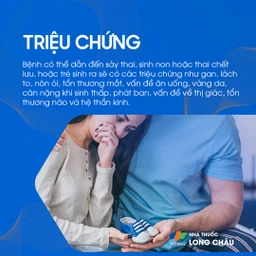 Nhiễm Toxoplasmosis bẩm sinh 2