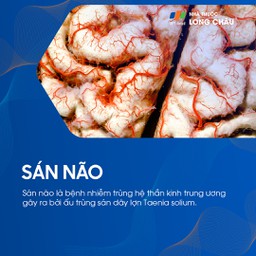 Sán não 1