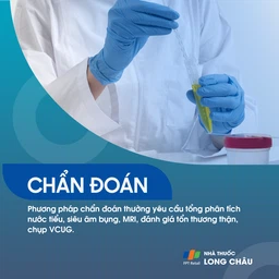 Nang niệu quản 5