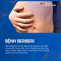Bệnh Beriberi 1