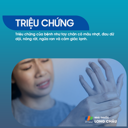 Bệnh Buerger 2