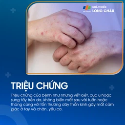 Phong 2