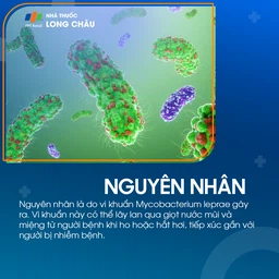 Phong 3