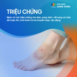 Bong gân cổ chân 2