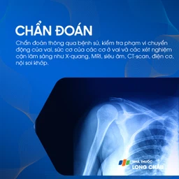 Đau bả vai 5