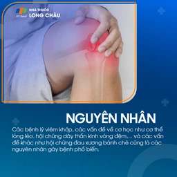 Đau đầu gối 4