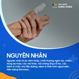 Đau ngón tay 3