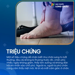 Phù chân 2