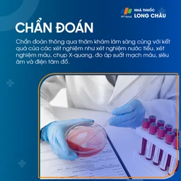 Phù chân 5