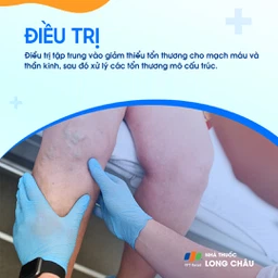 Trật khớp gối 7