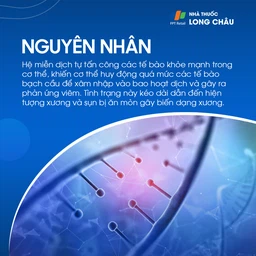 Viêm khớp tự miễn 4
