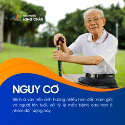 Á vảy nến 3