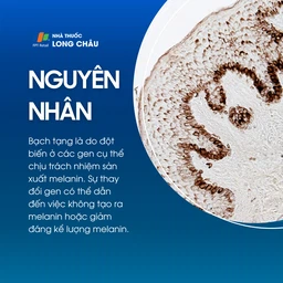 Bạch tạng 3