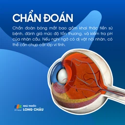 Bỏng mắt 5