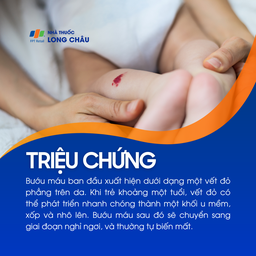 Bướu máu 2