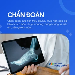 Đau bàn chân 4