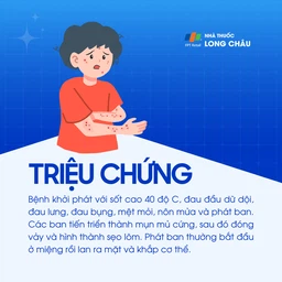 Đậu mùa 2