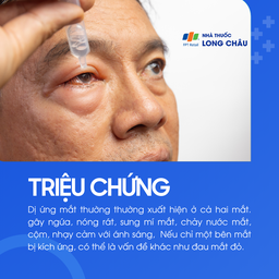 Dị ứng mắt 2