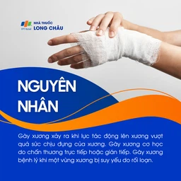 Gãy xương 3