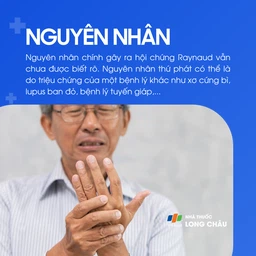 Hội chứng raynaud 3