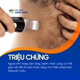 Hội chứng người sói 2