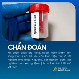 Lao họng 5