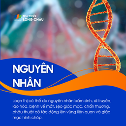 Loạn thị 3