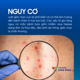 Loét giác mạc 4