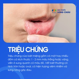 Loét miệng 2