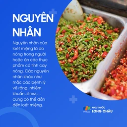Loét miệng 3