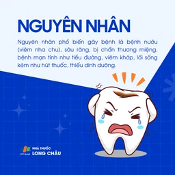Mất răng 3