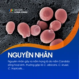 Nấm họng 3