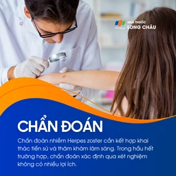 Nhiễm Herpes Zoster 7