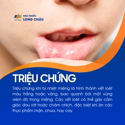 Nhiệt miệng 2