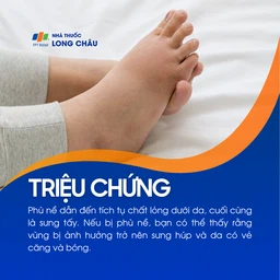 Phù nề 2