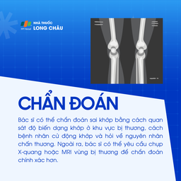 Sai khớp 5