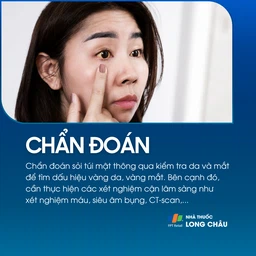 Sỏi túi mật 5