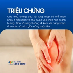 Sưng khớp 2