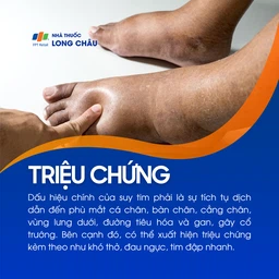 Suy tim phải 2